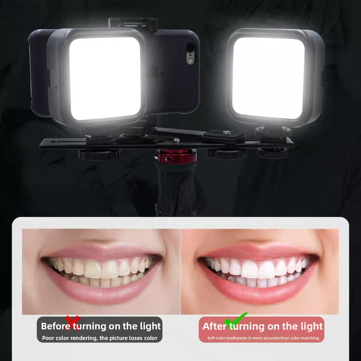 Dental Photography Light with  - Photography Basics ulasan dan harga